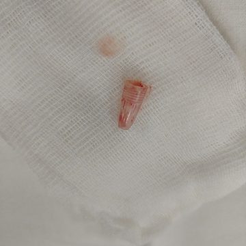 Дети, Здоровье