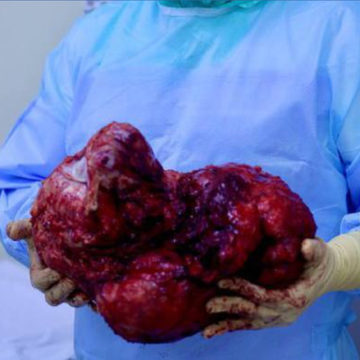 Здоровье, Медицина, Город Обнинск, Калужская область, МРНЦ, Обнинск