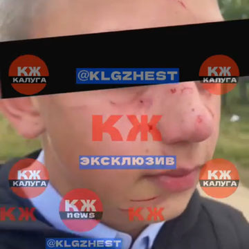 Дети, Драка, Криминал, Школы, Город Калуга, Калужская область
