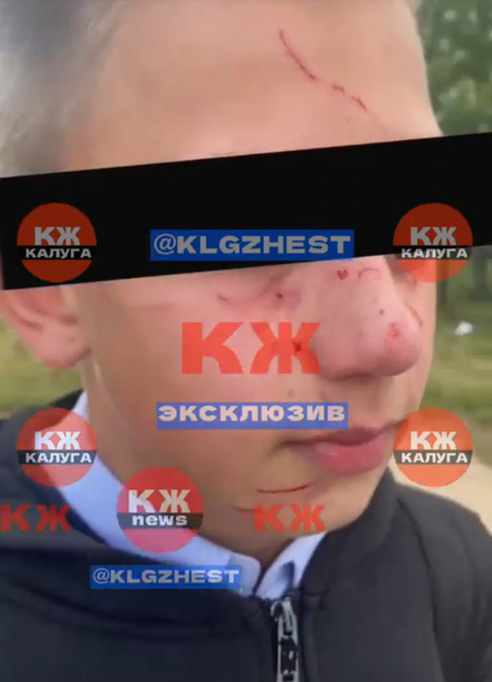 Дети, Драка, Криминал, Школы, Город Калуга, Калужская область