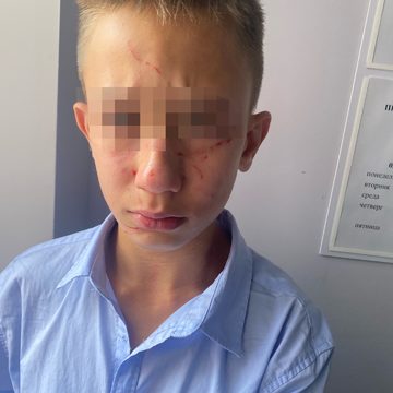 Дети, Драка, Криминал, Школы, Город Калуга, Калужская область